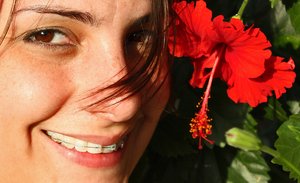 Braces & Flower: My wife Linda Pulgar shows off her braces with a nice cayenne flower